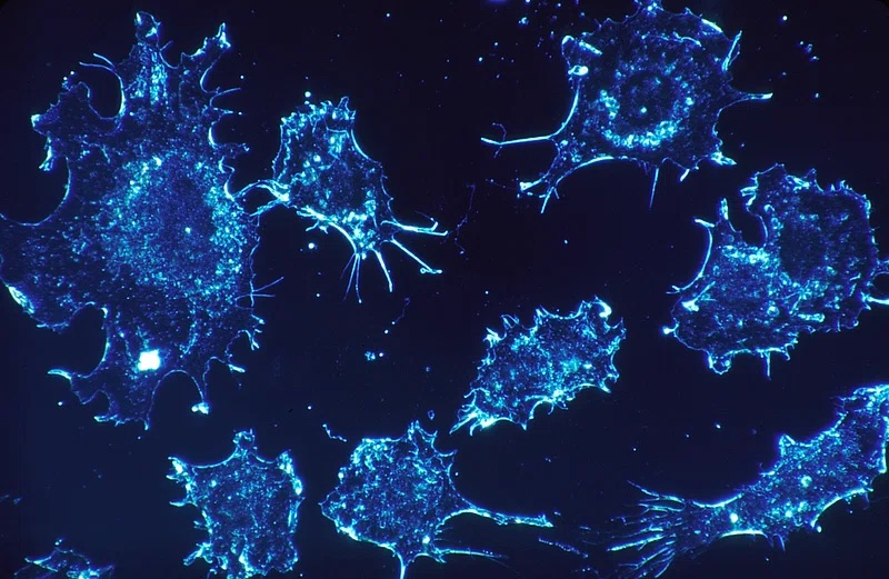 Blue Cancer Cells