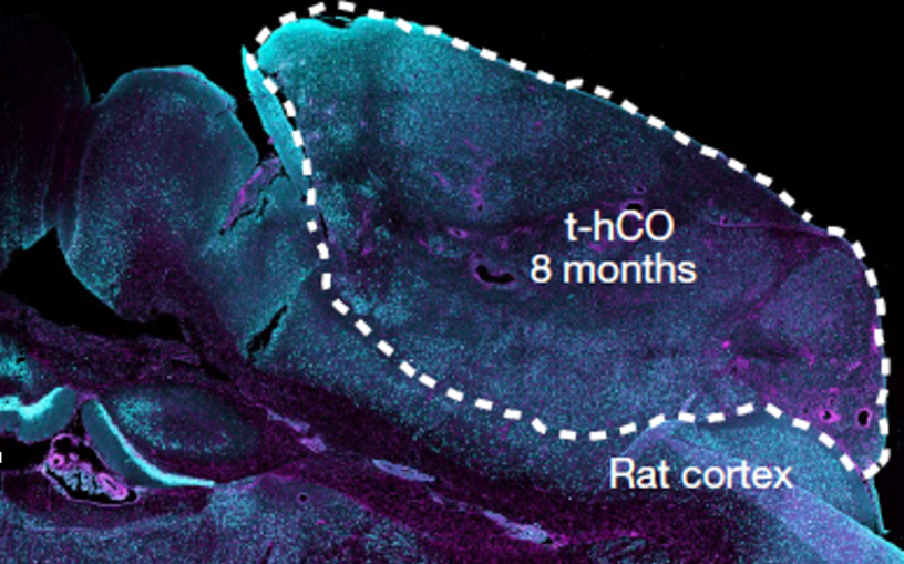 Image of t-hCO in Rat Cortex