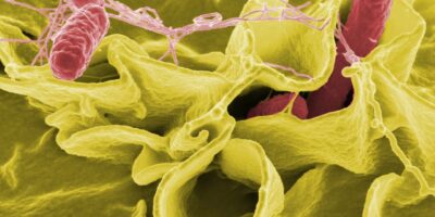 Salmonella bacteria